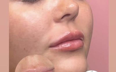 Facial Aesthetics Vs Traditional Skincare: What’s the Difference